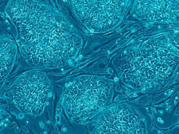 Ethisch saubere Stammzellen?
